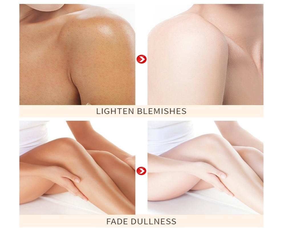 body lotion before after rough knees body lotion before after rough knees