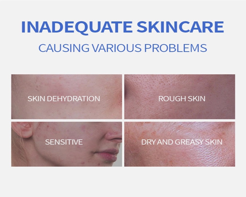 applying dark spot correction cream on face applying dark spot correction cream on face