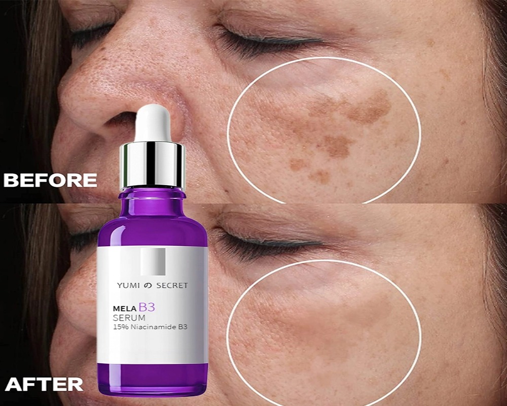 custom niacinamide serum custom niacinamide serum