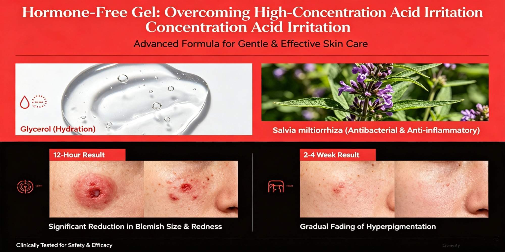 Private label acne gel Private label acne gel